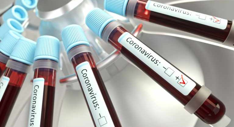 Empresa testa positivo em humano vacina contra coronavírus