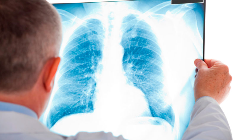 Oncologista explica diferenças de sintomas da asma e coronavírus