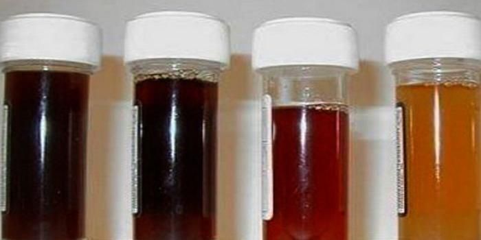 Ufam realiza estudo técnico sobre "urina preta" e toxinfecção