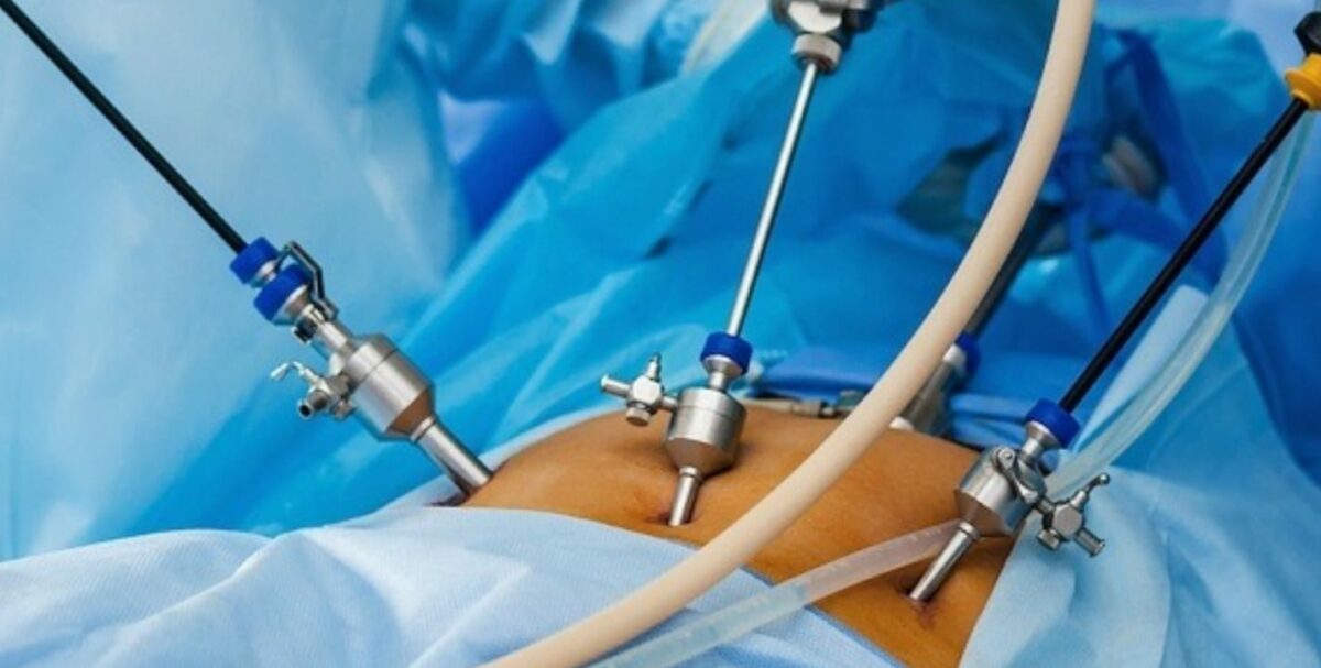 Cirurgia bariátrica de graça, no SUS, é oferecida em estado do Norte