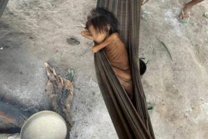 Vítima de desnutrição, morre criança indígena ianomâmi